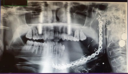 Dental xray Hospital up close Rory Dental xray Hospital up close Rory