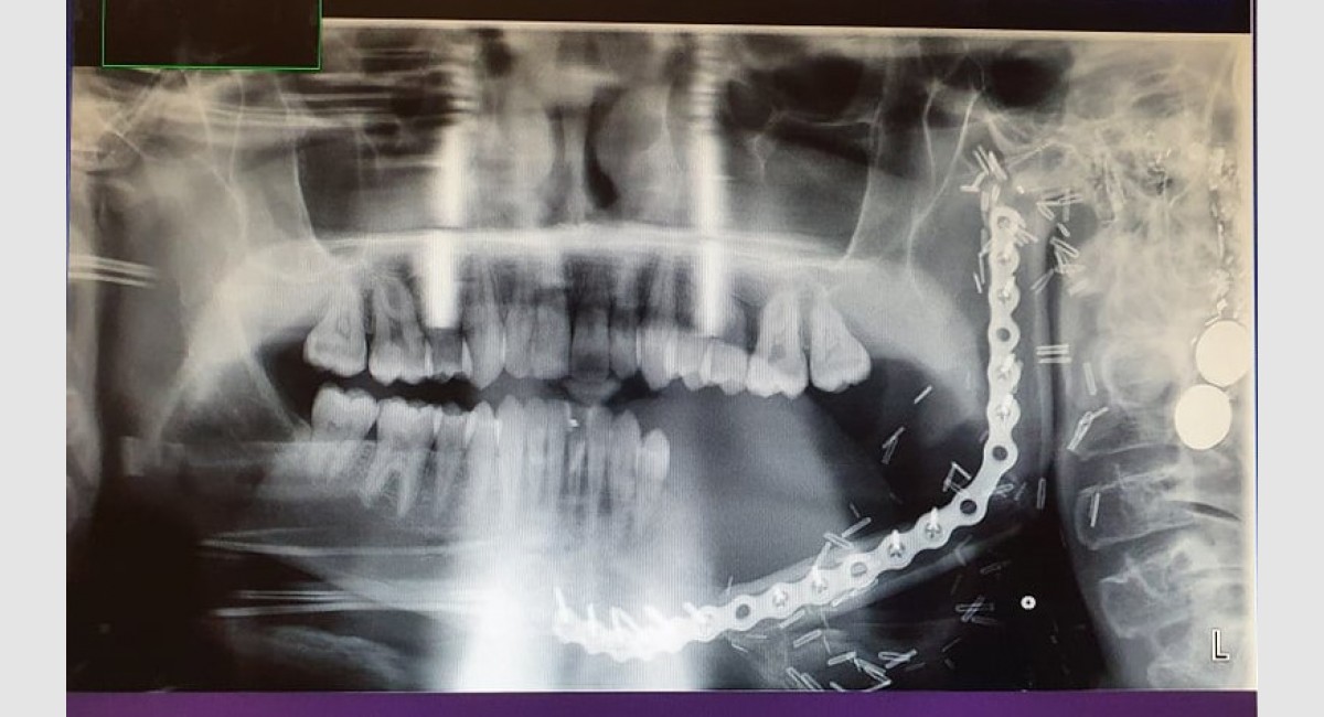 Dental xray Hospital up close Rory