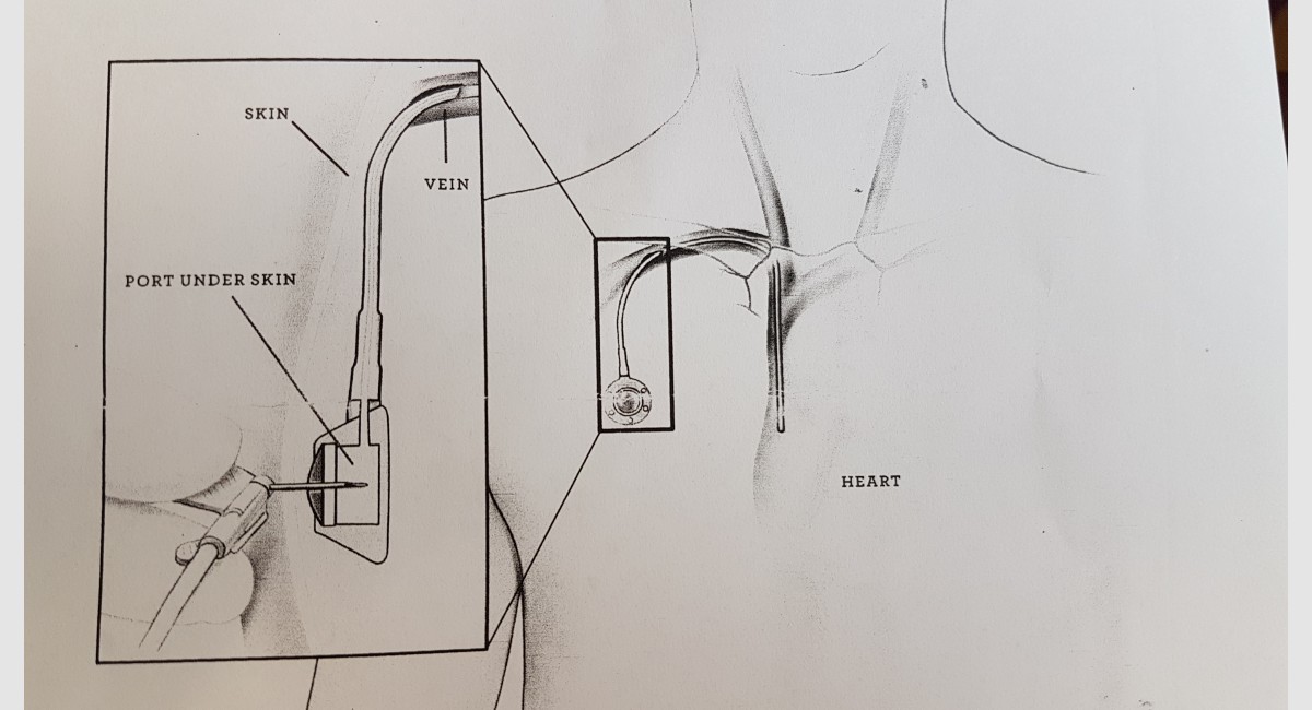 Port diagram